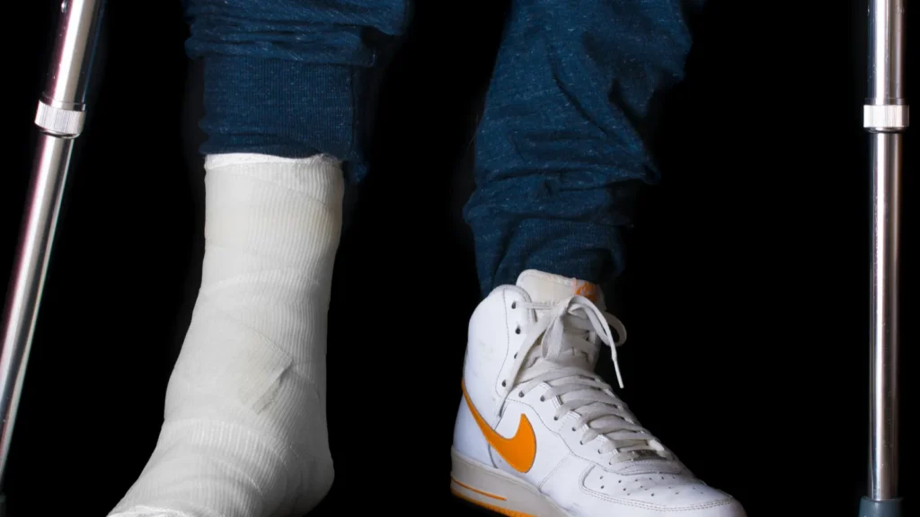 young man with a broken ankle and a leg cast