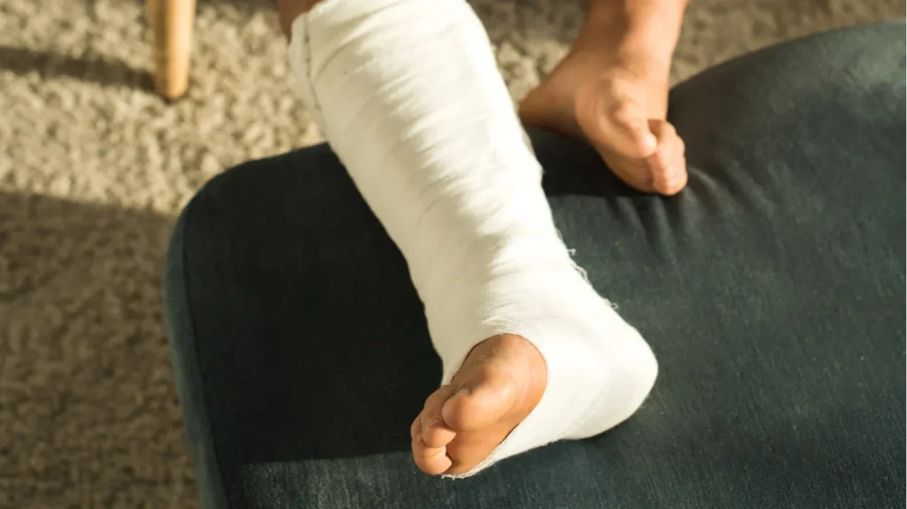 KYIV UKRAINE  JANUARY 21 2020 Selective focus of man with broken leg playing video game in armchair