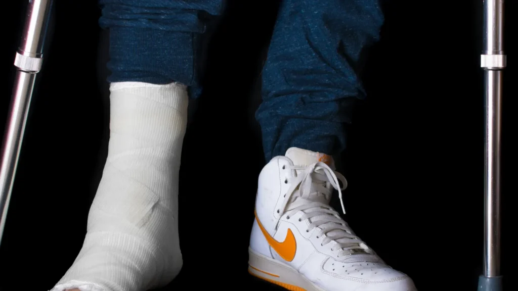 Young man with a broken ankle and a leg cast