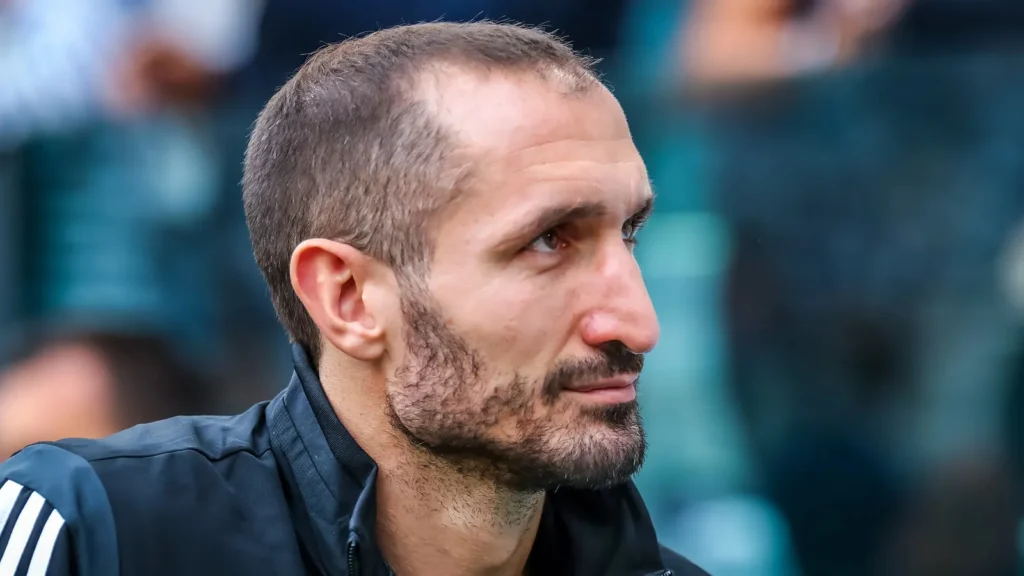 Chiellini before a game